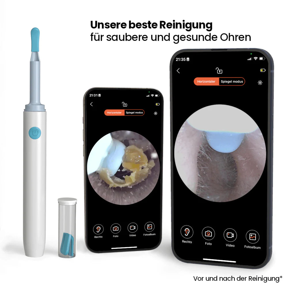 CleanEar Pro™ - Sanfte Ohrreinigung