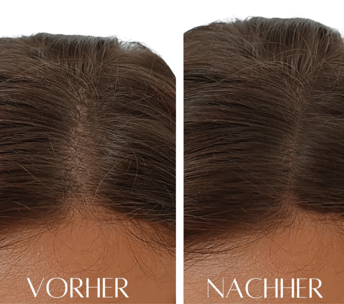 HairGlow Pro™ -3in1 Wachstum