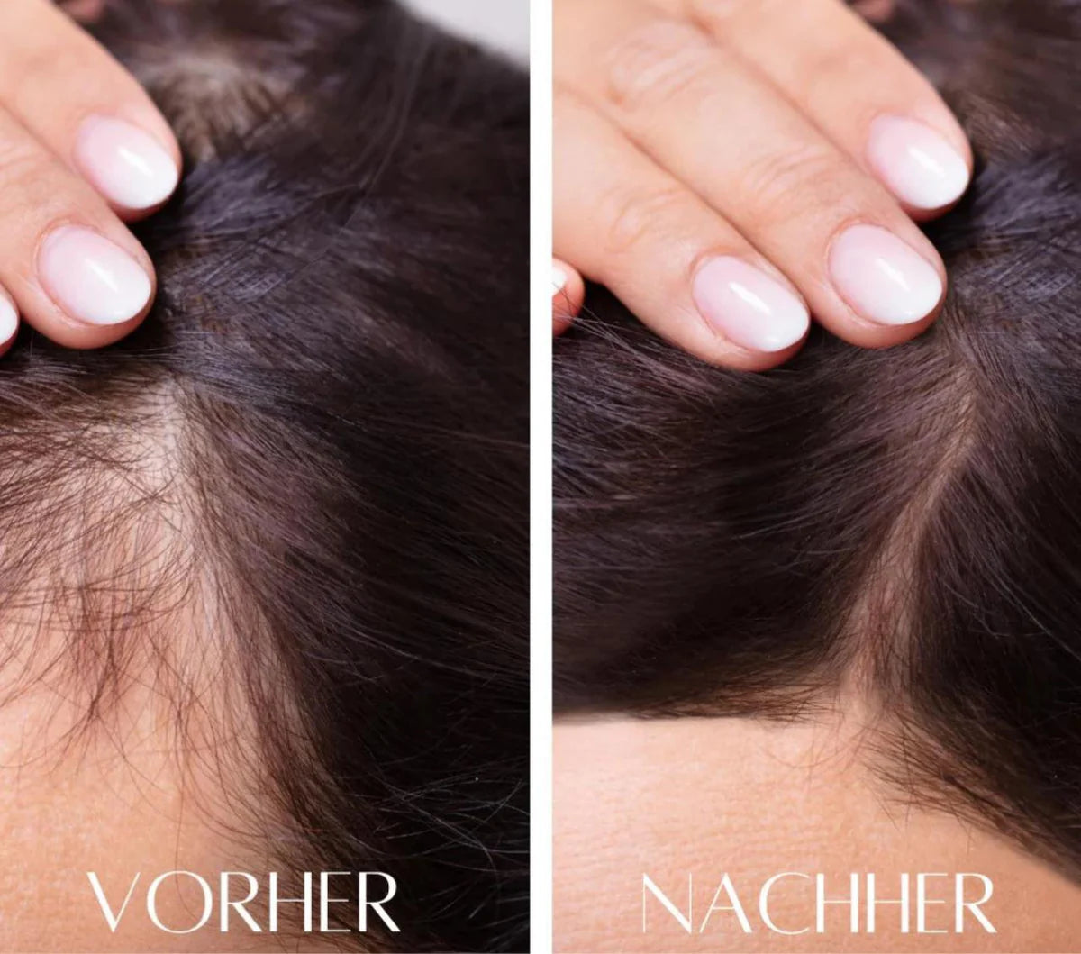 HairGlow Pro™ -3in1 Wachstum