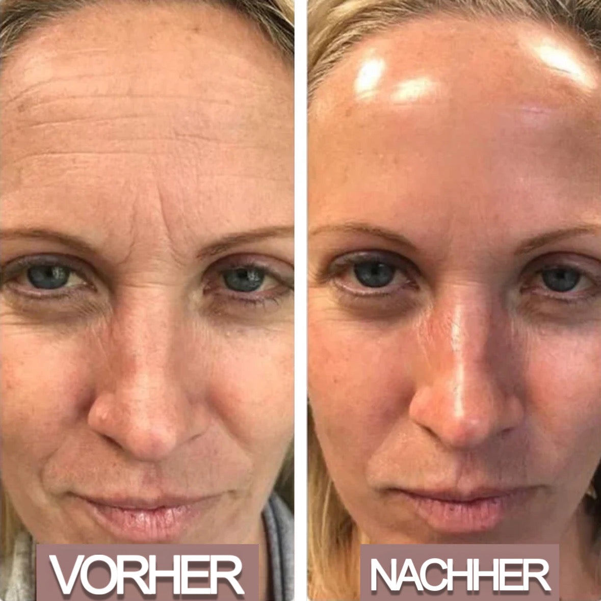 GlowEssence™ - Verjüngende Maske