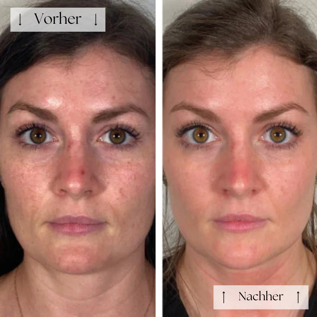 LumiGlow Mask™ – Strahlende Haut