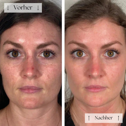 LumiGlow Mask™ – Strahlende Haut