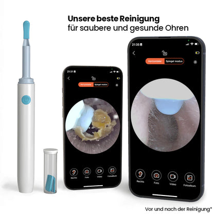 CleanEar Pro™ - Sanfte Ohrreinigung
