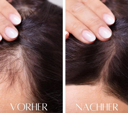 HairGlow Pro™ -3in1 Wachstum